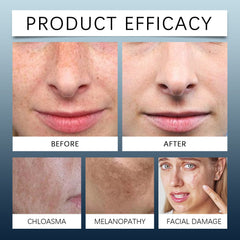 Jaysuing - Day & Night Cream Kit