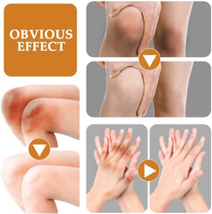 Jaysuing - Dark Spot Correcting Cream